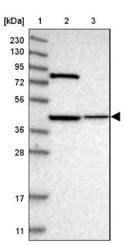 DHRS13 Antibody, Novus Biologicals 0.1mL; Unlabeled:Antibodies, Polyclonal